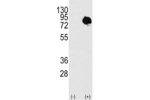 Western blot analysis of TG2 antibody and 293 cell lysate (2 ug/lane) either nontransfected or transiently transfected with the TGM2 gene. (Transglutaminase 2 antibody  (AA 413-442))