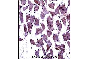 TrkA-p Antibody ((ABIN652381 and ABIN2841827))immunohistochemistry analysis in formalin fixed and paraffin embedded human skeletal muscle followed by peroxidase conjugation of the secondary antibody and DAB staining.
