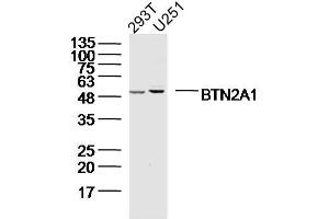 Lane 1: 293T; Lane 2: U251 cell lysates probed with BTN2A1 Polyclonal Antibody, Unconjugated (bs-20473R) at 1:300 overnight at 4˚C. (BTN2A1 antibody  (AA 101-200))