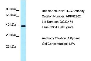 Western Blotting (WB) image for anti-Protein Phosphatase 1, Regulatory Subunit 3C (PPP1R3C) (N-Term) antibody (ABIN2789287) (PPP1R3C antibody  (N-Term))