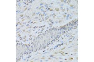 Immunohistochemistry of paraffin-embedded mouse esophagus using AIFM1 Antibody (ABIN5971393) at dilution of 1/200 (40x lens).