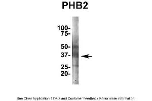 IP Suggested AntiPhb2 Antibody Positive Control: NT2 CELL/BRAIN TISSUE (Prohibitin 2 antibody  (Middle Region))