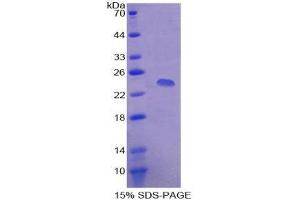 SDS-PAGE (SDS) image for Amyloid P Component, Serum (APCS) (AA 20-223) protein (His tag) (ABIN1171341) (APCS Protein (AA 20-223) (His tag))
