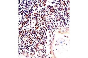 Paraformaldehyde-fixed, paraffin embedded Human Thymus tissue, Antigen retrieval by boiling in sodium citrate buffer (pH6. (H2AFX antibody)