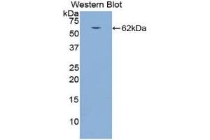 Detection of Recombinant CTSA, Dog using Polyclonal Antibody to Cathepsin A (CTSA) (CTSA antibody  (AA 234-494))