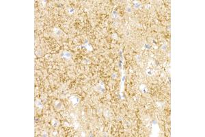 Immunohistochemistry of paraffin-embedded human brain using NgR3 Rabbit mAb (ABIN7269932) at dilution of 1:50 (40x lens). (RTN4RL1 antibody)