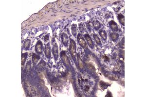 Immunohistochemistry (IHC) image for anti-Insulin-Like Growth Factor 2 Receptor (IGF2R) (AA 424-529) antibody (ABIN5693085)