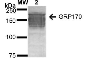 Western Blot analysis of Human Embryonic kidney epithelial cell line (HEK293) lysates showing detection of ~170 kDa GRP170 protein using Mouse Anti-GRP170 Monoclonal Antibody, Clone 6G7-2H5 (ABIN2868659).