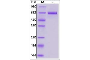 SDS-PAGE (SDS) image for CD276 (CD276) (AA 29-245) protein (Fc Tag,AVI tag,Biotin) (ABIN5954964)