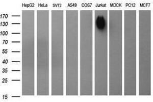 Image no. 1 for anti-Protein tyrosine Phosphatase, Receptor Type, C (PTPRC) antibody (ABIN1497331)