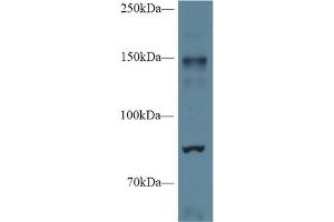 Western blot analysis of Mouse Cerebrum lysate, using Mouse NOS2 Antibody (1 µg/ml) and HRP-conjugated Goat Anti-Rabbit antibody ( (NOS2 antibody  (AA 43-213))