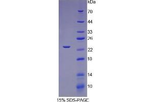 SDS-PAGE (SDS) image for Slow Skeletal Troponin I (TNNI1) (AA 1-187) protein (His tag) (ABIN1081039)