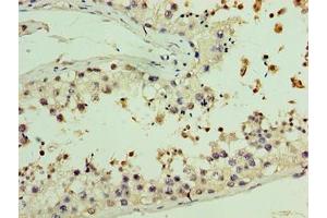 Immunohistochemistry of paraffin-embedded human testis tissue using ABIN7157782 at dilution of 1:100 (AASDHPPT antibody  (AA 1-309))
