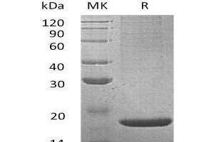 Western Blotting (WB) image for Regenerating Islet-Derived 2 (REG2) protein (His tag) (ABIN7320608) (REG2 Protein (His tag))