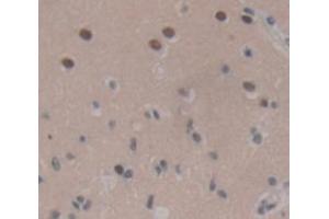 Figure. (LIM Domain Binding 1 Protein antibody  (AA 112-411))