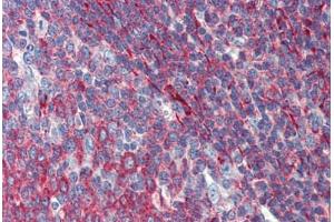 Tonsil, Human: Formalin-Fixed, Paraffin-Embedded (FFPE) (PHACTR1 antibody  (AA 468-517))