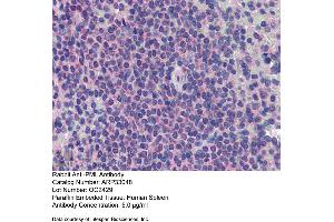 Immunohistochemistry (IHC) image for anti-Promyelocytic Leukemia (PML) (C-Term) antibody (ABIN2777721)