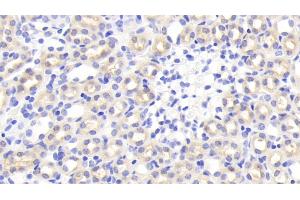 Detection of TNIP2 in Mouse Kidney Tissue using Polyclonal Antibody to Tumor Necrosis Factor Alpha Induced Protein 3 Interacting Protein 2 (TNIP2) (TNIP2 antibody  (AA 170-413))