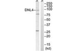 Western blot analysis of extracts from Jurkat cells, using DNL4 Antibody. (LIG4 antibody  (AA 591-640))