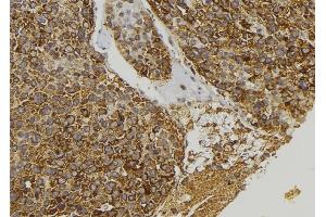 ABIN6273393 at 1/100 staining Human pancreas tissue by IHC-P. (CCL23 antibody)