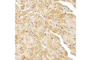 Immunohistochemistry of paraffin-embedded mouse heart using ACTN1 antibody at dilution of 1:100 (400x lens). (ACTN1 antibody)