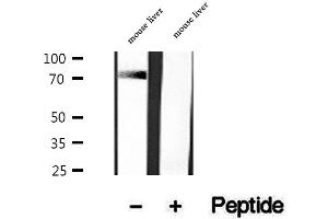 Western blot analysis of extracts of mouse liver tissue, using DNAJC10 antibody. (DNAJC10 antibody  (C-Term))