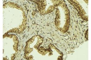 ABIN6274193 at 1/100 staining Mouse colon tissue by IHC-P. (TFE3 antibody  (Internal Region))