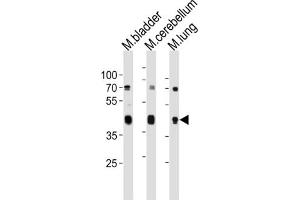 Western Blotting (WB) image for anti-Cholecystokinin A Receptor (CCKAR) antibody (ABIN3004717)