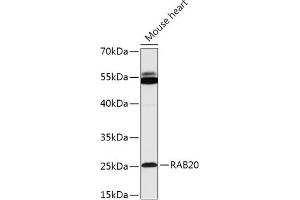 Western blot analysis of extracts of Mouse heart, using R antibody (ABIN7269800) at 1:1000 dilution. (RAB20 antibody  (AA 80-190))