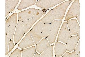 ABIN7094355 and ABIN7098402 at 1/100 staining Mouse muscle tissue by IHC-P.