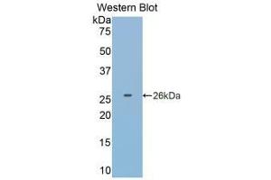 Detection of Recombinant GSTp, Human using Monoclonal Antibody to Glutathione S Transferase Pi (GSTp) (GSTP1 antibody  (AA 1-210))