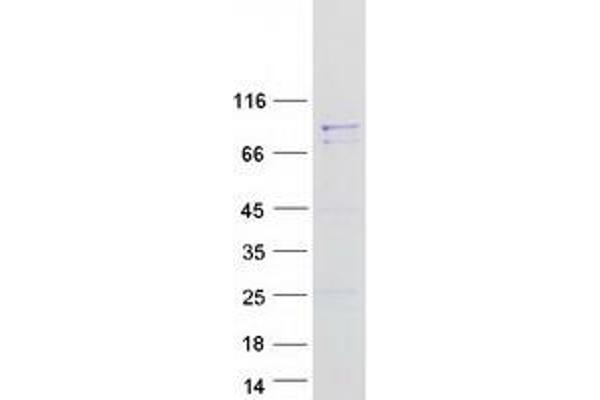 C12orf11 Protein (Myc-DYKDDDDK Tag)
