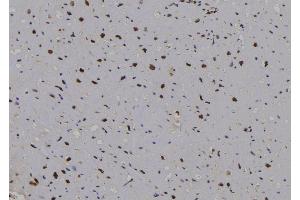 ABIN6276871 at 1/100 staining Human heart tissue by IHC-P. (Cyclin D2 antibody  (C-Term))