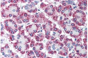 Human Pancreas (formalin-fixed, paraffin-embedded) stained with CPA1 antibody ABIN214091 at 5 ug/ml followed by biotinylated goat anti-rabbit IgG secondary antibody ABIN481713, alkaline phosphatase-streptavidin and chromogen. (CPA1 antibody  (AA 24-73))