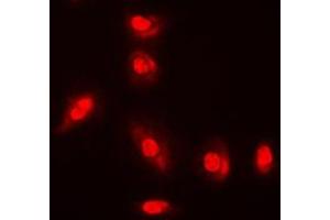Immunofluorescent analysis of AKT (pY315) staining in A549 cells. (AKT1 antibody  (pTyr315))