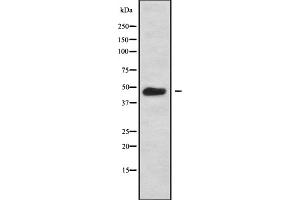 Western blot analysis GPRC5C using COS7 whole cell lysates (GPRC5C antibody)