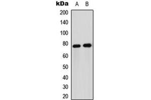 Western blot analysis of FOXO1 expression in Jurkat (A), HeLa (B) whole cell lysates.