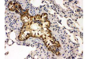 Anti- GRK5 Picoband antibody,IHC(P) IHC(P): Mouse Lung Tissue (GRK5 antibody  (C-Term))