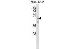TMPRSS5 Antibody (N-term) western blot analysis in NCI-H292 cell line lysates (35 µg/lane). (TMPRSS5 antibody  (N-Term))