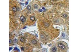 Immunohistochemistry (IHC) image for anti-Fibrinogen beta Chain (FGB) (AA 29-118) antibody (ABIN7438250)