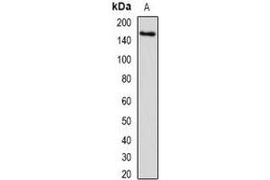 Western blot analysis of SETD5 expression in human liver (A) whole cell lysates. (SETD5 antibody)