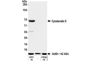 Western Blotting (WB) image for anti-Keratin 5 (KRT5) (C-Term) antibody (ABIN7795755)
