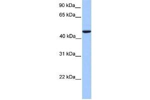 Human Lung; WB Suggested Anti-REXO4 Antibody Titration: 0. (REXO4 antibody  (Middle Region))