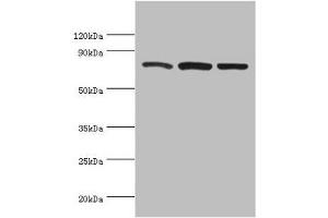 Western blot All lanes: Calpain-1 catalytic subunit antibody at 2 μg/mL Lane 1: A431 whole cell lysate Lane 2: Hela whole cell lysate Lane 3: Jurkat whole cell lysate Secondary Goat polyclonal to rabbit IgG at 1/10000 dilution Predicted band size: 82 kDa Observed band size: 82 kDa