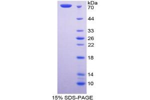 SDS-PAGE analysis of Human Fibulin 4 Protein. (FBLN4 Protein)