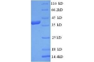 SDS-PAGE (SDS) image for Eukaryotic Translation Initiation Factor 4 Gamma, 1 (EIF4G1) (AA 1250-1599), (partial) protein (His tag) (ABIN5713424) (EIF4G1 Protein (AA 1250-1599, partial) (His tag))