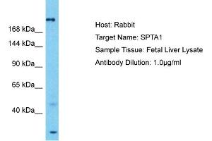 Host: Rabbit Target Name: SPTA1 Sample Tissue: Human Fetal Liver Antibody Dilution: 1ug/ml (SPTA1 antibody  (N-Term))