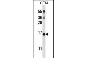 C Antibody (C-term) (ABIN656407 and ABIN2845701) western blot analysis in CEM cell line lysates (35 μg/lane). (CJ057 antibody  (C-Term))