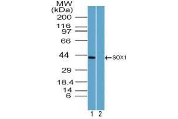 SOX1 antibody  (AA 100-150)