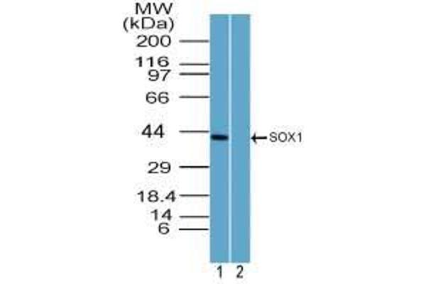 SOX1 Antikörper  (AA 100-150)
